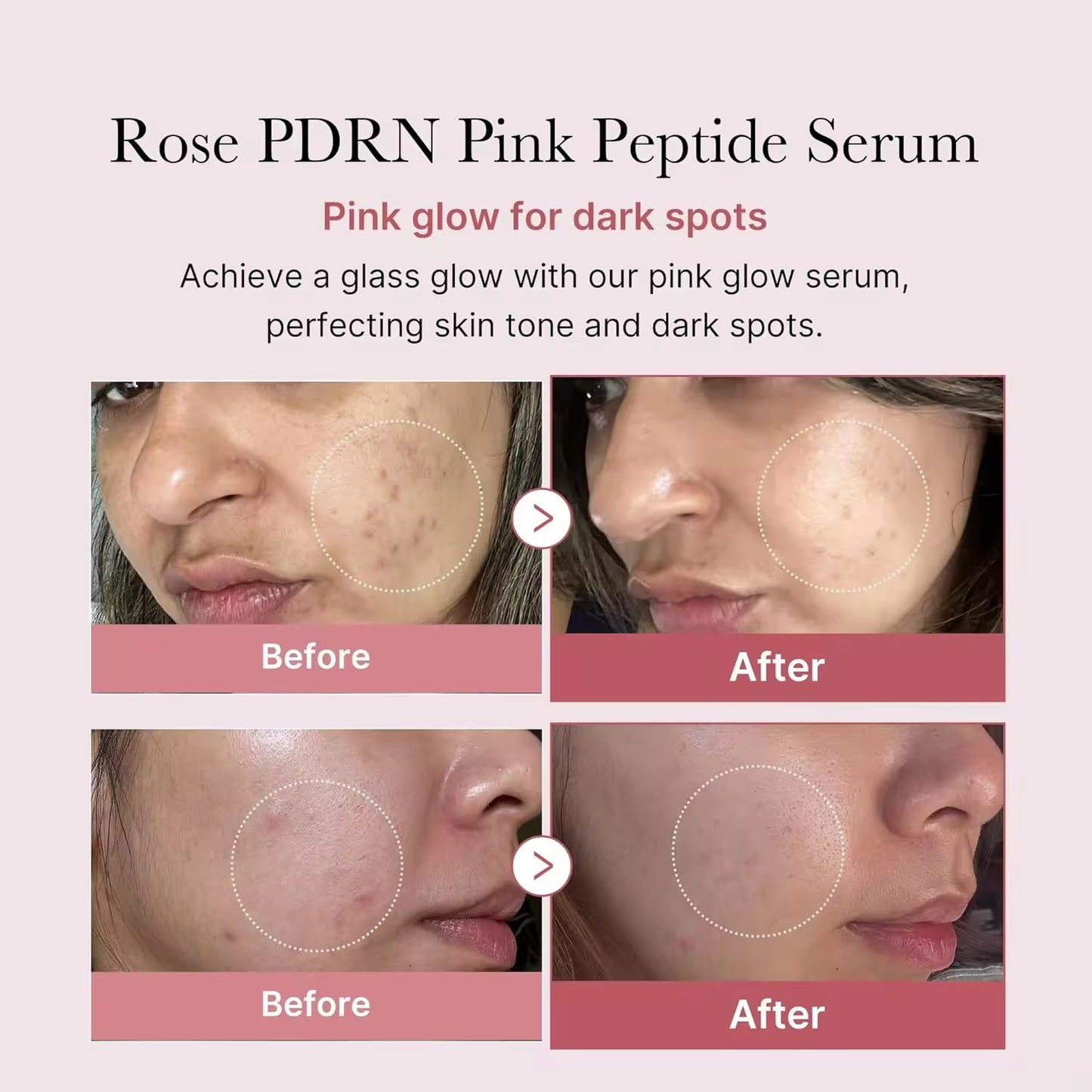 Wholesale Same Medicube PDRN Pink Peptide Serum Korea Vegan Skincare Hydrating Moisturizing Firming Even Skin Tone