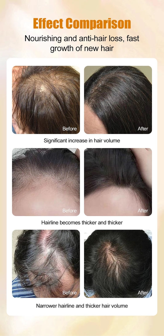 Wholesale Custom Hair Growth Oil Serum Hair Growth Care Essence Scalp Care Nourishing Serum Hair Care Essential Oil