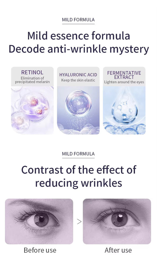 Ocheal Anti-Wrinkle Rolling Ball Eye Cream Herbal Ingredients for All Skin Types-Moisturizing Hydrating Eye Essence Reduces Eye