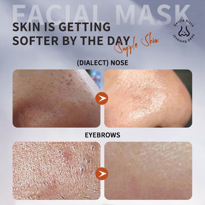 OEM blackhead killer face mask China manufacturer