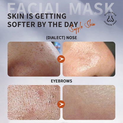 OEM blackhead killer face mask China manufacturer