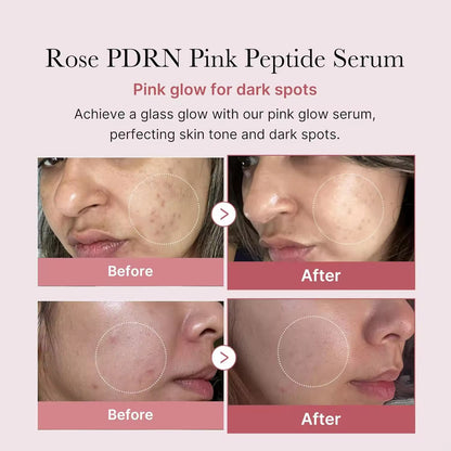 Wholesale Same Medicube PDRN Pink Peptide Serum Korea Vegan Skincare Hydrating Moisturizing Firming Even Skin Tone