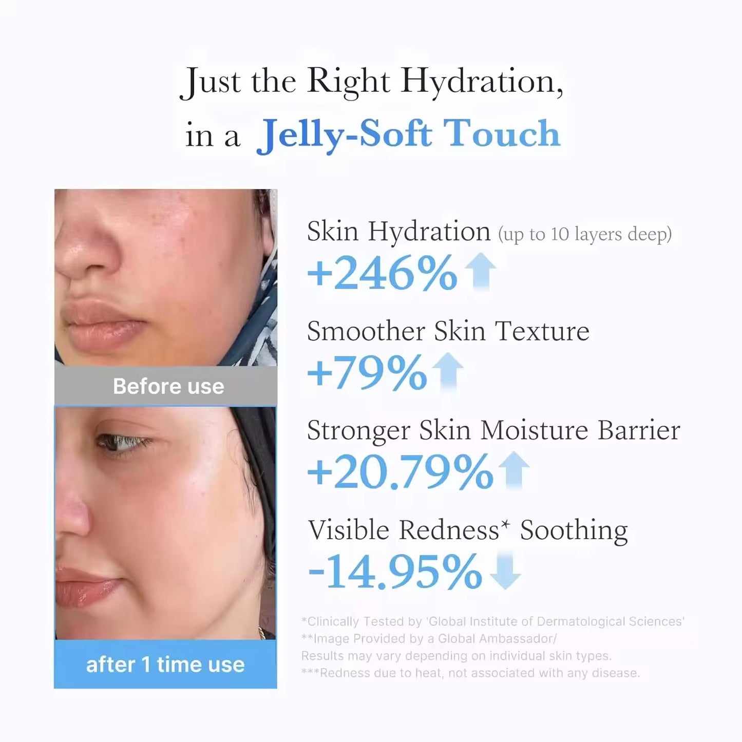 Medicub Hyaluronic Acid Moisturizing Jelly Cream Daily Moisturizer Long-lasting Hydration Supports Skin's Natural Barrier