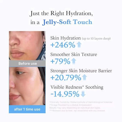Medicub Hyaluronic Acid Moisturizing Jelly Cream Daily Moisturizer Long-lasting Hydration Supports Skin's Natural Barrier