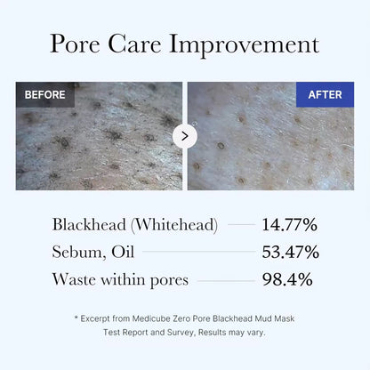 Medicube Home Care Duo for Flawless Skin: Zero Pore Blackhead Mud Facial Mask and Zero Foam Cleanser Free Brush