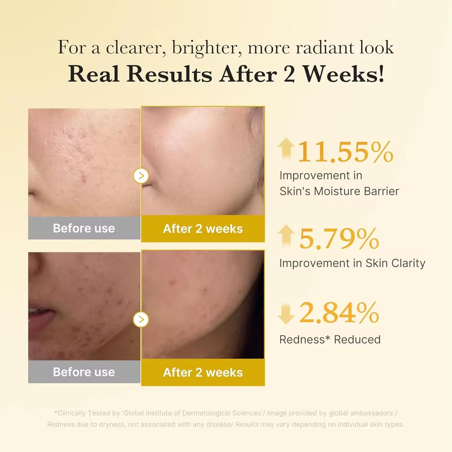 Wholesale Customization: Medicube Bearberry & Turmeric Clarifying & Balancing Serum for Problem Skin