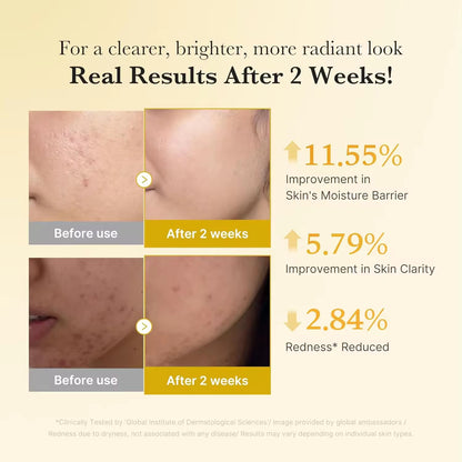 Wholesale Customization: Medicube Bearberry & Turmeric Clarifying & Balancing Serum for Problem Skin