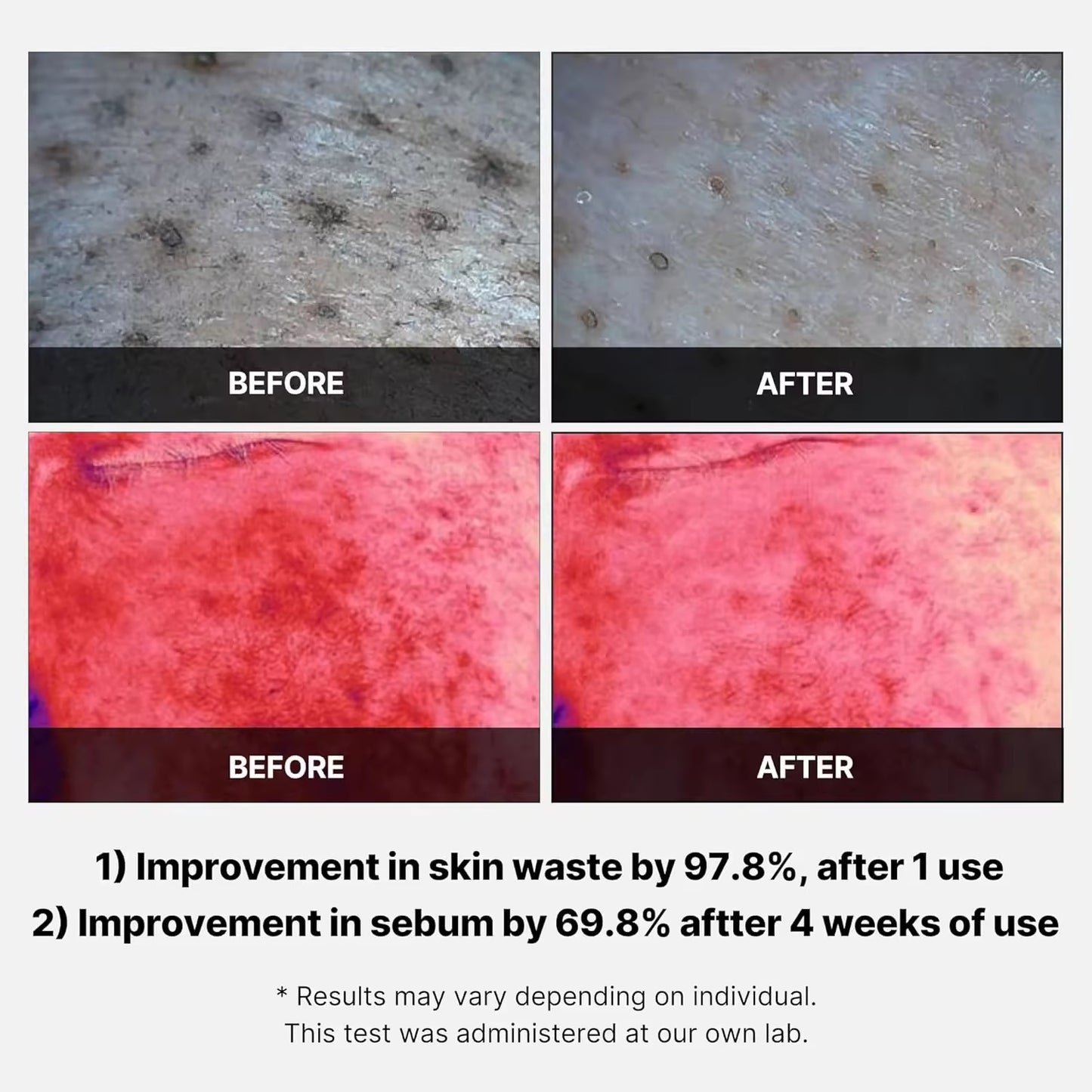 Wholesale Customized Korean Skincare Medicube Red Succinic Acid Toner Exfoliating Cotton Pads Niacinamide AHA BHA Acne Relief