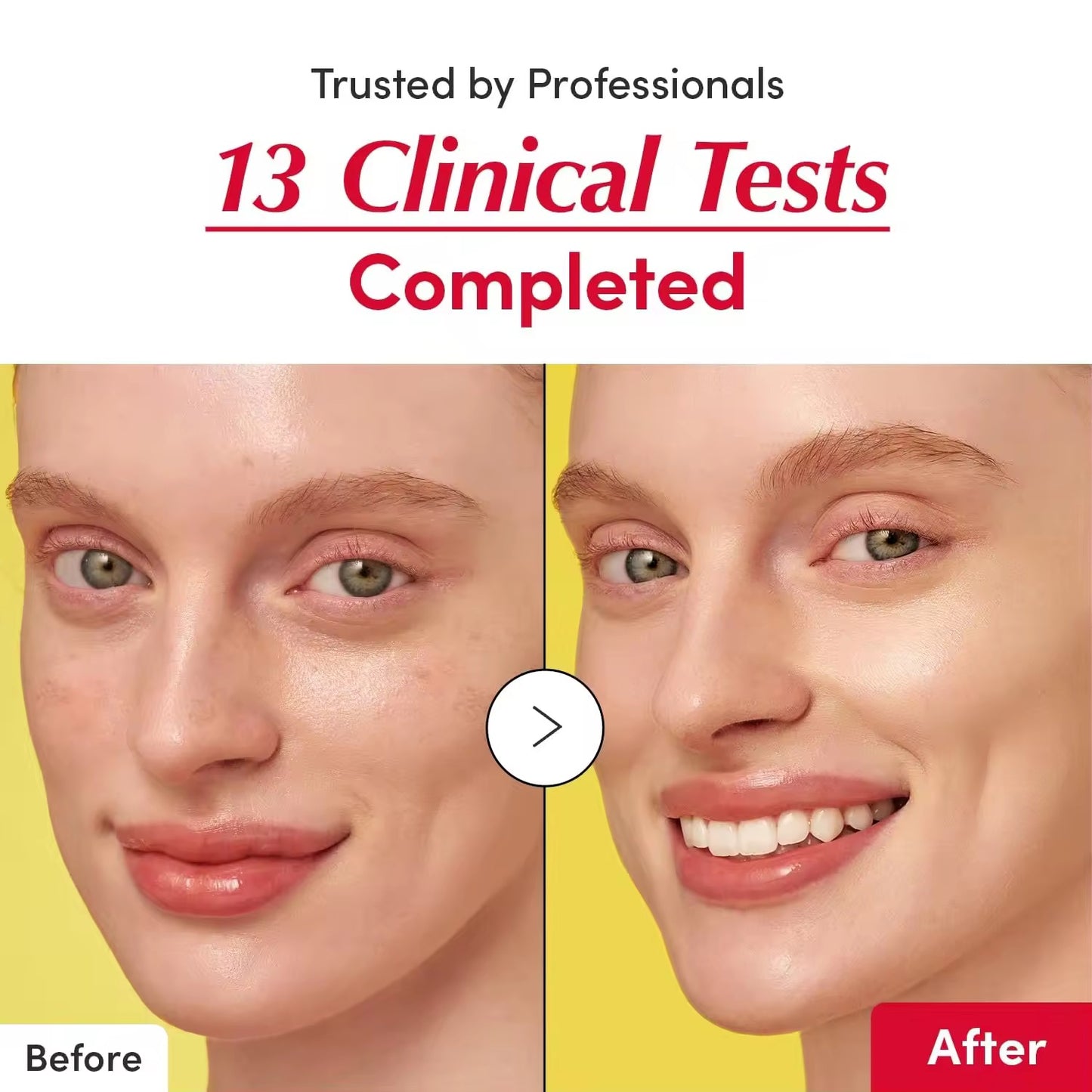 Wholesale Customized Korean SkinCare Vitamin Niacinamide Brightening Serum Repair Skin Barrier Ceramide and Hyaluronic Acid