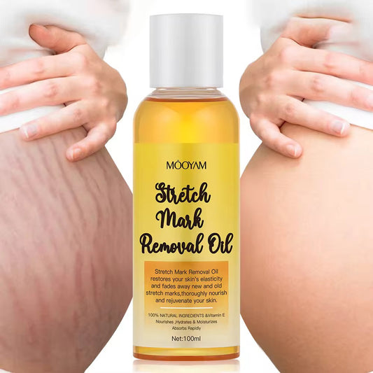 Wholesale Customization Stretch Mark Removal & Postpartum Tightening Body Oil with Moisturizing & Soothing Benefits Firming Skin