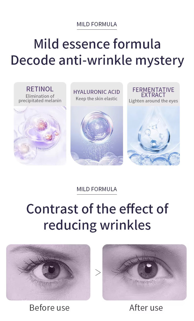 Ocheal Anti-Wrinkle Rolling Ball Eye Cream Herbal Ingredients for All Skin Types-Moisturizing Hydrating Eye Essence Reduces Eye