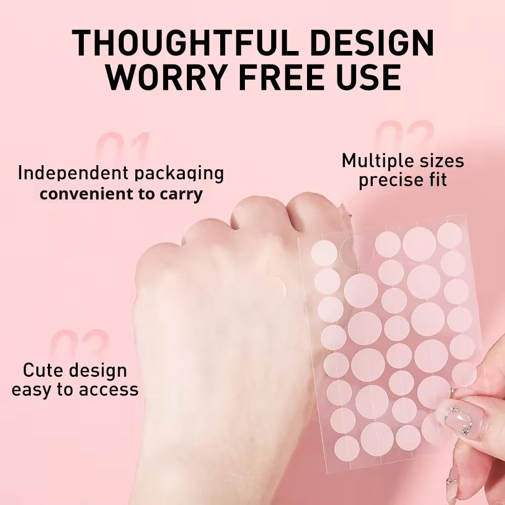 MOIKA Herbal Hydrocolloid Salicylic Acid Acne Patches Pimple Whitehead Facial Acne Removal 36 Patches Boxed for Wholesale