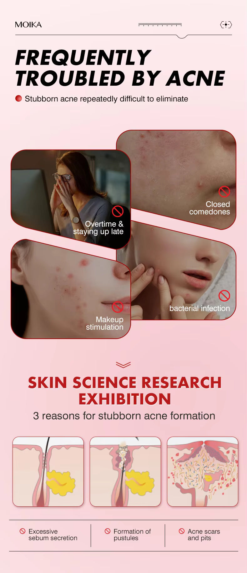 MOIKA Herbal Hydrocolloid Salicylic Acid Acne Patches Pimple Whitehead Facial Acne Removal 36 Patches Boxed for Wholesale